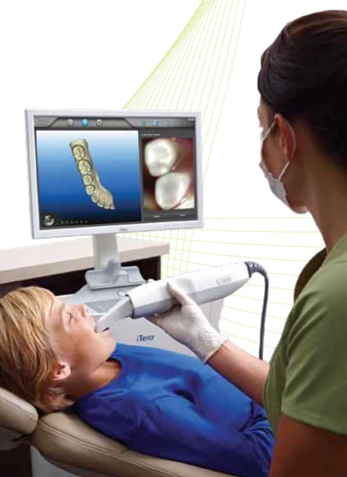 iTero Intraoral Scanner- The Best Technology For Individualized ...